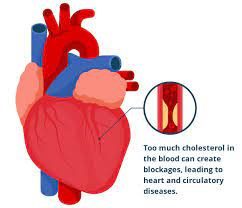 Cholesterol management image