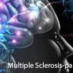 Multiple Sclerosis-panrum image