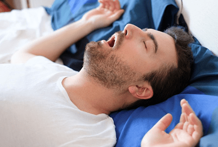 obstructive sleep apnea - new 2023 - v4
