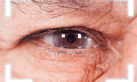 glaucoma - new 2023 -imagev4